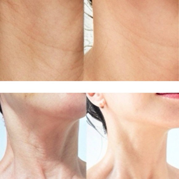 MEDIPEEL⁺ Premium 3.0 Collagen Naite Thread Neck Cream (100ml) | Ecoplace